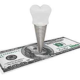 Model showing the cost of dental implants.